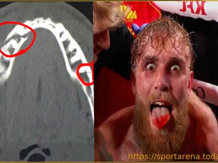 Джейк Пол рассказал о двойном переломе челюсти и сроках своего возвращения в бокс